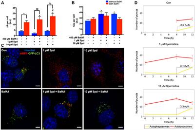 Investigating the Role of Spermidine in a Model System of Alzheimer’s Disease Using Correlative Microscopy and Super-resolution Techniques